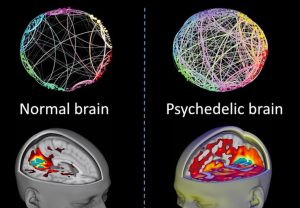 LSD Neuroplasticity And A New Approach To Therapy